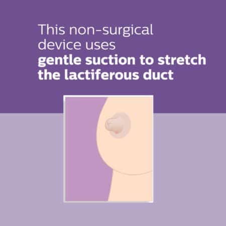 Philips AVENT Niplette For Inverted Nipples, 2 Pack, SCF152/02 - Image 4