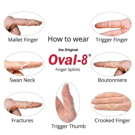 3-Point Products Original Oval-8 Finger Splints, Support and Protection for Arthritis, Tri - Image 2