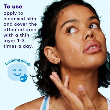 Clean & Clear Persa-Gel 10 Acne Medication Spot Treatment with Maximum Strength 10% Benzoy - Image 6