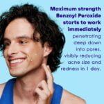 Clean & Clear Persa-Gel 10 Acne Medication Spot Treatment with Maximum Strength 10% Benzoy - Image 4