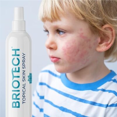 BRIOTECH Topical Skin Spray, Hypochlorous Acid Spray for Body & Face, Eyelid Cleanser, HOC - Image 6
