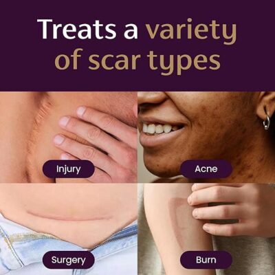 Mederma Advanced Scar Gel, Treats Old and New Scars, Reduces the Appearance of Scars from Acne, Stitches, Burns and More, 50 Grams - Image 3