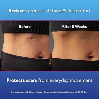 ScarAway Silicone Scar Gel, Helps Improve Size, Color & Texture of Hypertrophic & Keloid Scars from Injury, Burns & Surgery, Water Resistant, 10g (0.35 Oz) - Image 6