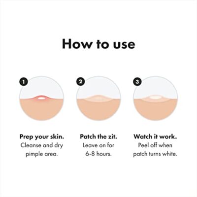 Mighty Patch Hero Cosmetics Original Patch - Hydrocolloid Acne Pimple Patch for Covering Zits and Blemishes, Spot Stickers for Face and Skin (36 Count) - Image 6