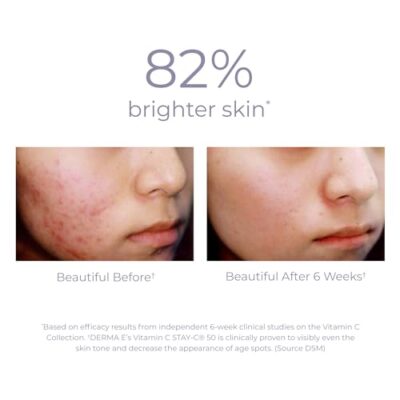 DERMA-E Vitamin C Intense Night Cream ? Brightening and Hydrating Facial Skin Renewing Cream ? Anti-Aging Overnight Facial Moisturizer, 2 oz - Image 3