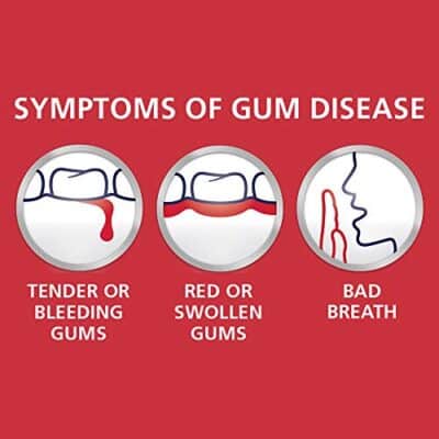 Parodontax Clean Mint Toothpaste for Bleeding Gums, 3.4 Ounce (Pack of 6) - Image 6
