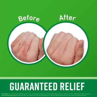 O'Keeffe's Working Hands Hand Cream, Relieves and Repairs Extremely Dry Hands, 3 oz Tube, (Bulk Hand Cream, Pack of 12) - Image 2