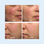First Aid Beauty Ultra Repair Cream 14 oz jar - Image 8
