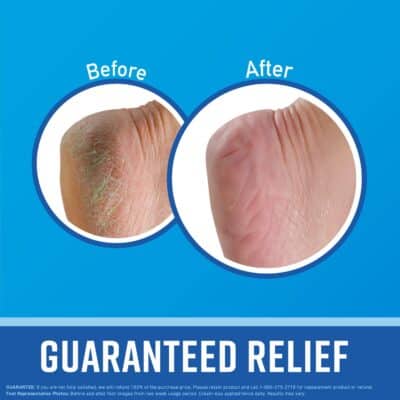 O'Keeffe's for Healthy Feet Foot Cream, Guaranteed Relief for Extremely Dry, Cracked Feet, Clinically Proven to Instantly Boost Moisture Levels, 3.0 Ounce Tube, (Pack of 1) - Image 2