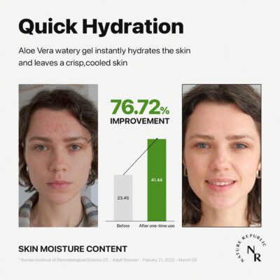 Nature Republic 3 PCS MILD & MOISTURE ALOE VERA WATERY GEL 10.56 fl. oz. Soothing Quick Hydration - Image 5