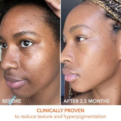 Dr Dennis Gross Alpha Beta Universal Daily Peel: for Uneven Tone or Texture and Fine Lines or Enlarged Pores, (30 Treatments) - Image 7