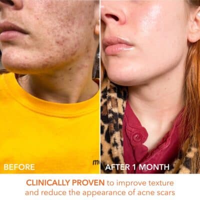 Dr Dennis Gross Alpha Beta Universal Daily Peel: for Uneven Tone or Texture and Fine Lines or Enlarged Pores, (30 Treatments) - Image 9