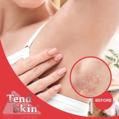 Tend Skin The Skin Care Solution For Unsightly Razor Bumps, Ingrown Hair And Razor Burns, 8 Fl Oz Bottle - Image 4