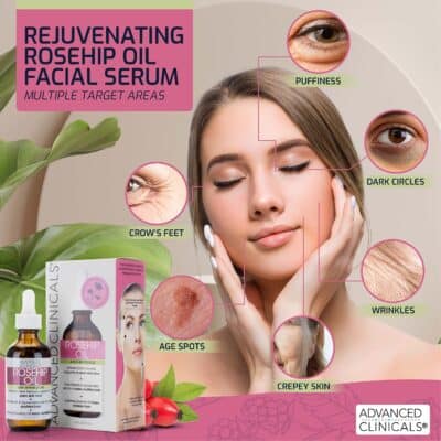 Advanced Clinicals Rosehip Oil For Face | Anti Wrinkle Facial Skin Care Serum | Vitamin C Serum Moisturizer Face Oil W/Vitamin E For Fine Lines, Dark Spots, Uneven Skin Tone, & Sun Damage, 1.8 Fl Oz - Image 4