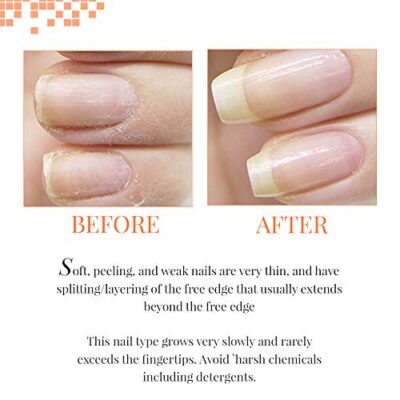 Nail Tek Foundation 2, Ridge Filling Strengthening Base Coat for Soft and Peeling Nails, 0.5 oz, 1-Pack - Image 4