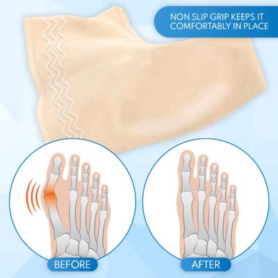 Bunion Correctors for Women and Men Relief for Big Toe Separator Gel Cushion Brace Splint Protector Support Hallux Valgus Hammer Toe Pain Inflammation Bunion Guard Shield Unisex to Align Bones in Feet - Image 7