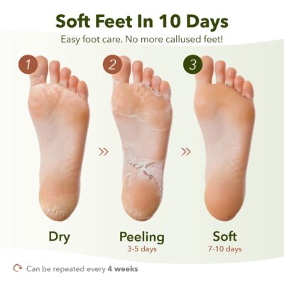 Purederm Shiny & Soft Foot Peeling Mask (3 pack) - For smooth and moist baby skin with Exfoliating peel off Calluses, Dry Skin, Cracked Heels - Men and Women - Image 3