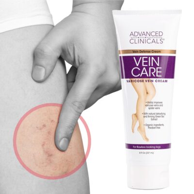 Advanced Clinicals Varicose Veins Cream For Legs | Spider Vein & Varicose Vein Cream | Collagen Cream | Vitamin K Cream | Arnica Cream | Strengthens Capillaries & Improves Circulation, 8 Fl Oz - Image 7