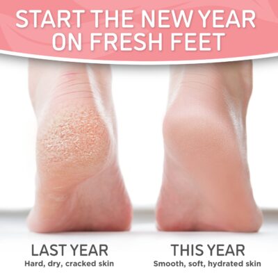Soft Touch Foot Peel Mask - Pack of 2 Feet Peeling Masks for Dry, Cracked Heels & Calluses - Exfoliating Foot Mask Peel for Baby Soft Skin (Original) - Image 4