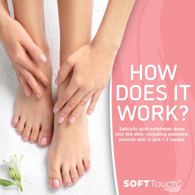 Soft Touch Foot Peel Mask - Pack of 2 Feet Peeling Masks for Dry, Cracked Heels & Calluses - Exfoliating Foot Mask Peel for Baby Soft Skin (Original) - Image 6