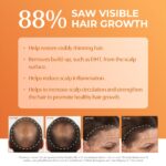 BosleyMD BosRevive Volumizing Conditioner for Noticeably Thinning and Color/Chemically-Treated Hair, 33.8 Fl Oz - Image 3